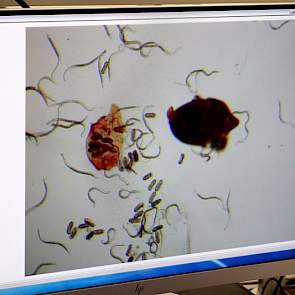 Een live-microscopisch beeld van de activiteiten en ontwikkelingsstadia van bietencysteaaltjes.